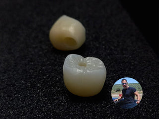 2024-09-14 case:    From:Columbia     Author:Jhon    Material:3D Pro Multilayer speed fire 4h