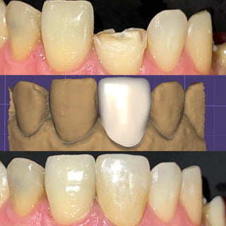 3D Pro Multilayer Zirconia Block Sirona System
