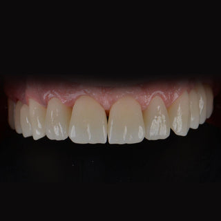 ST+Color Precolored Zirconia Block Zirkonzahn System 95mm