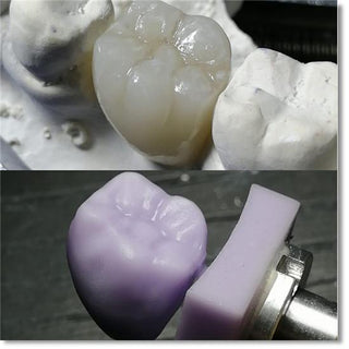 Lithium Disilicate Blocks(Glass Ceramic)—C14/B32/B40-HT/LT 5 Pieces