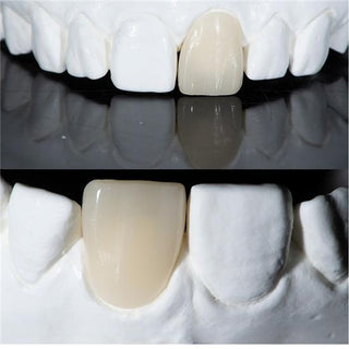 Lithium Disilicate Blocks(Glass Ceramic)—C14/B32/B40-HT/LT 10 Pieces