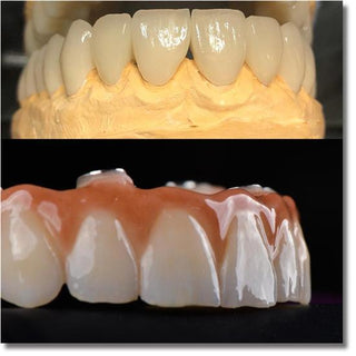 Sistema Sirona de bloco de zircônia multicamadas UTEx Pro